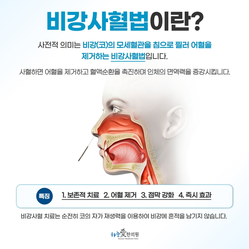 비강사혈의 개념과 적용 부위를 정리한 원본 안내 이미지
