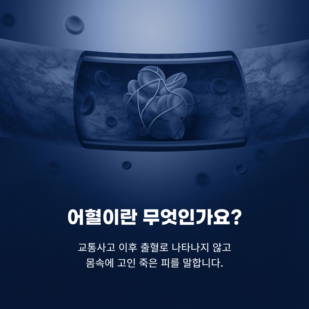 어혈이란 교통사고 이후 출혈로 나타나지 않고 몸속에 고인 죽은 피를 말한다는 문구와 혈관 도해가 있는 안내 이미지